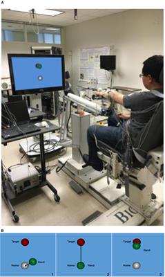 Reducing the Impact of Shoulder Abduction Loading on the Classification of Hand Opening and Grasping in Individuals with Poststroke Flexion Synergy